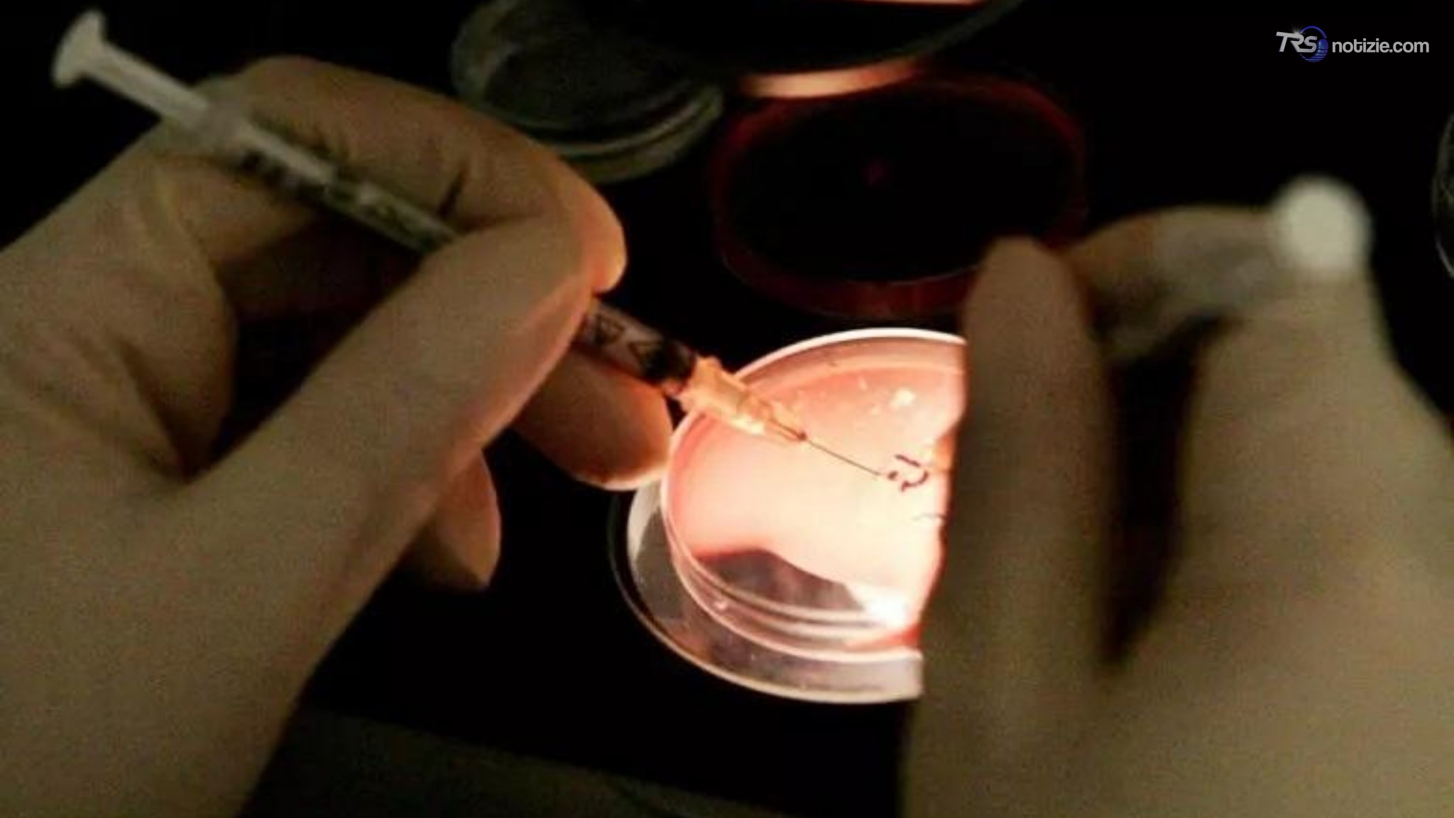 Il dramma della fecondazione in vitro al San Paolo: "Riconosciuta e amata, ma distrutta la fiducia"