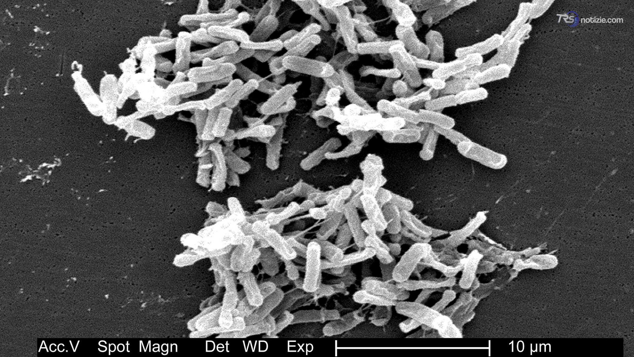 Bimbo di 18 mesi morto in ospedale a Catanzaro, cos'è il "Clostridium difficile" e come si trasmette