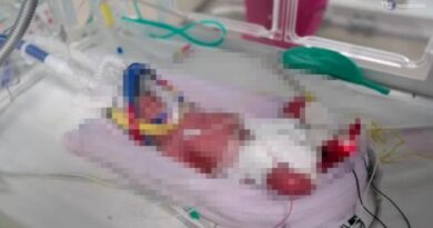 Australia, parto record: 4 gemelle identiche nella stessa placenta: "Un caso su 15 milioni"