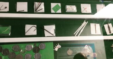 Batterie a bottone, allarme del Bambino Gesù: sei ricoveri in tre mesi per gravi lesioni all’esofago