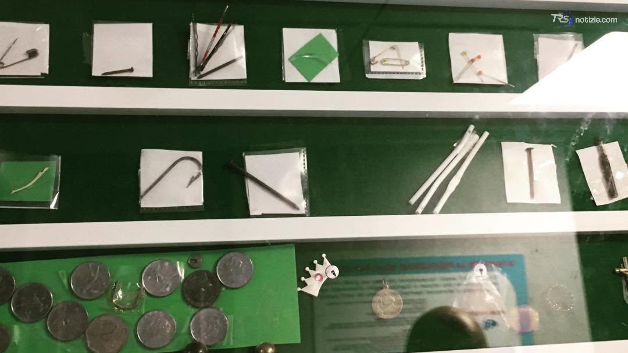 Batterie a bottone, allarme del Bambino Gesù: sei ricoveri in tre mesi per gravi lesioni all’esofago