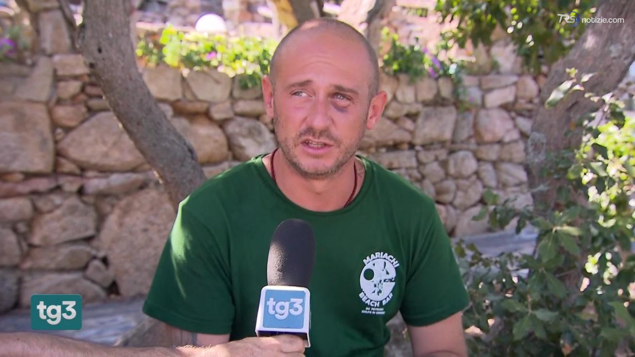 Brutale pestaggio ad Olbia: membro di un collettivo queer finito in ospedale