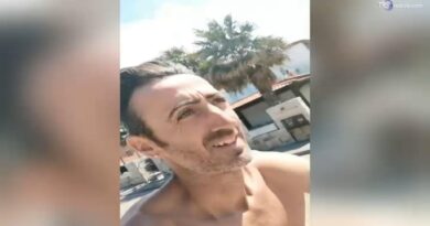 Il pugno che ha ucciso Diomede: frattura importante della mandibola e del naso