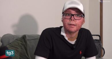 Kean Talingdan, superstite di Crans Montana: «Più rabbia che dolore, ma il futuro è un obiettivo»