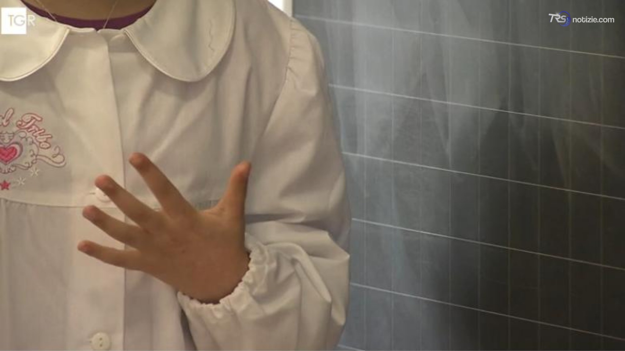 Difterite, l'associazione dei dirigenti scolastici: "In attesa della linee guida"