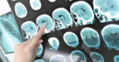 Alzheimer, la malattia che ruba i ricordi: 600mila gli italiani colpiti