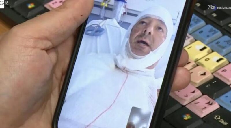 Caccia alla donna che ha gettato dell'acido addosso a un avvocato a Messina