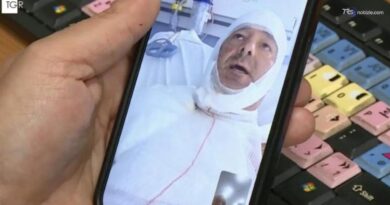 Donna aggredisce l'avvocato con l'acido. Parla l'uomo sfregiato